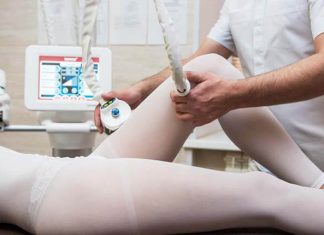 What is laser liposuction?